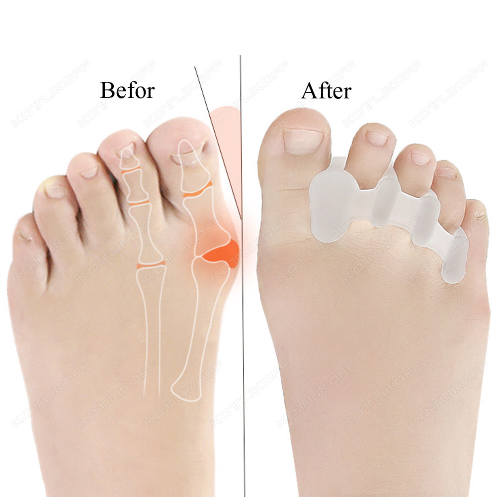 تو واقية أصابع فاصل سيليكون ال - مراجعة Shoe Polish Cream وسعره